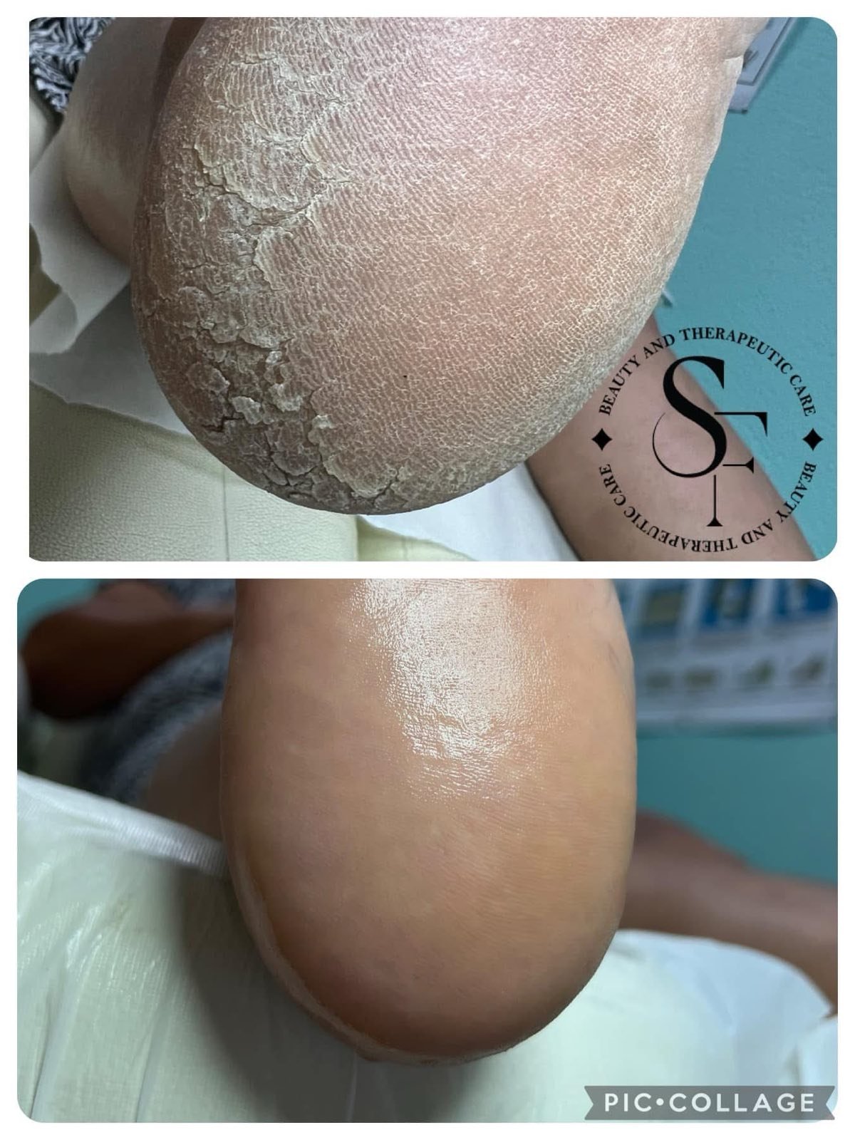 Комплект "Цялостна хидратация"