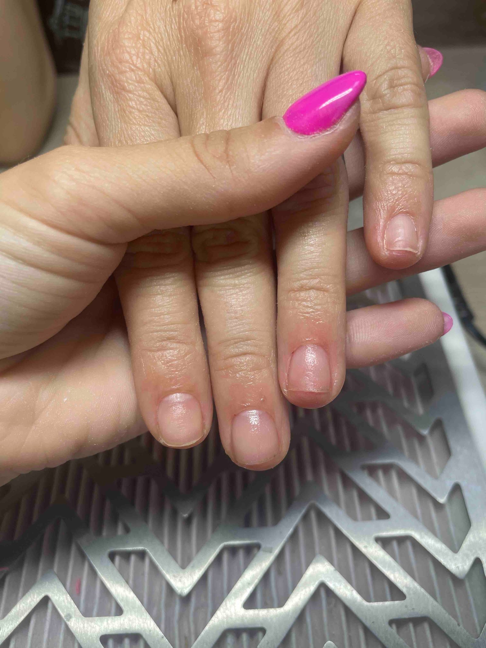 Комплект "Възстановяване" (ръце)