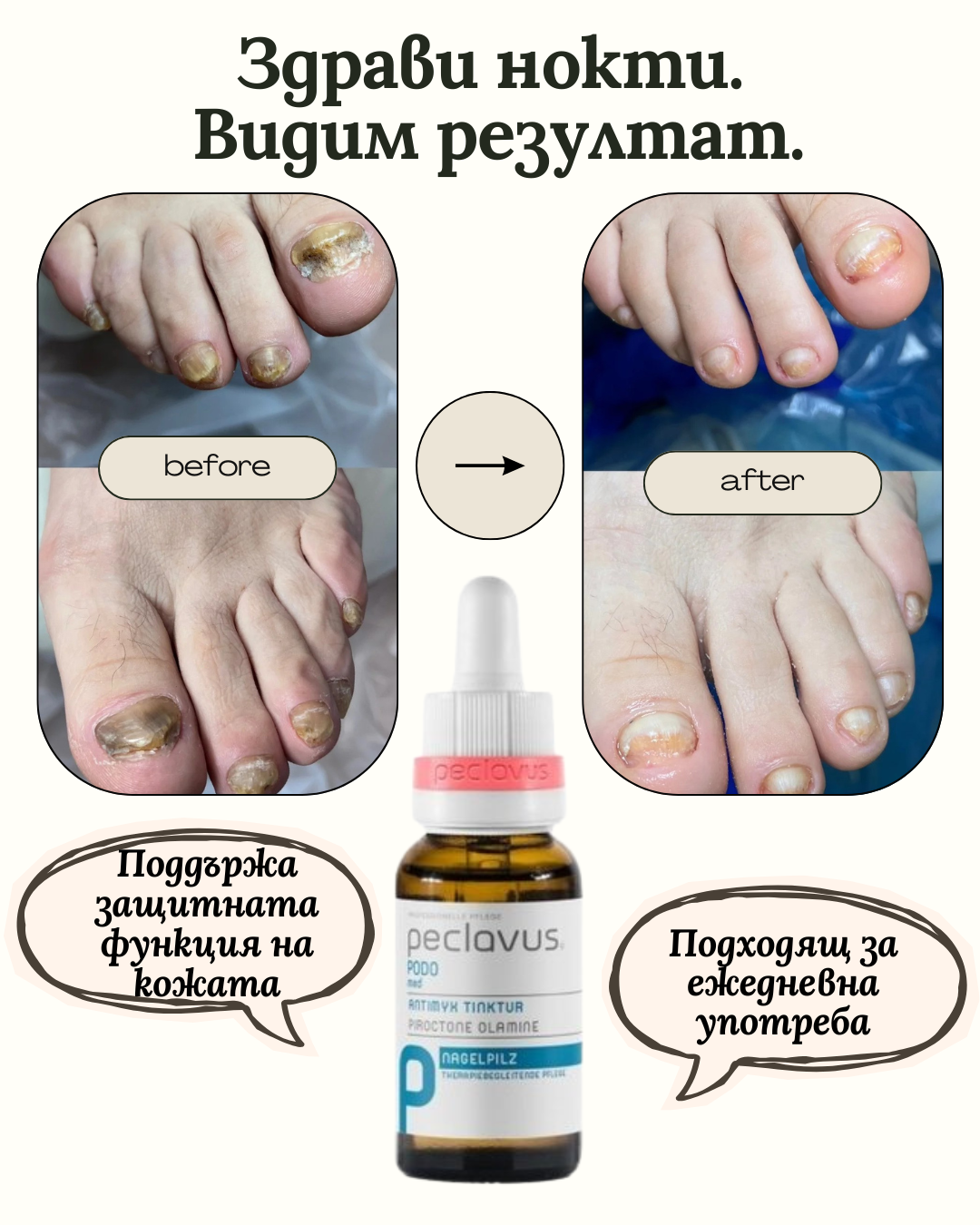 Peclavus Антимикотична тинктура 20мл.